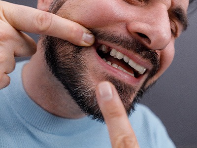 A man playfully pointing out his missing tooth