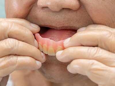 A senior woman putting dentures in her mouth