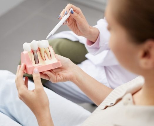 Dentist using smile model to explain the dental implant process