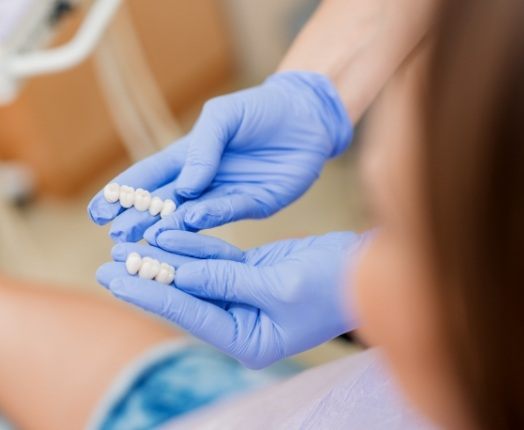 Dentist showing dentistry patient dental bridge options to replace missing teeth