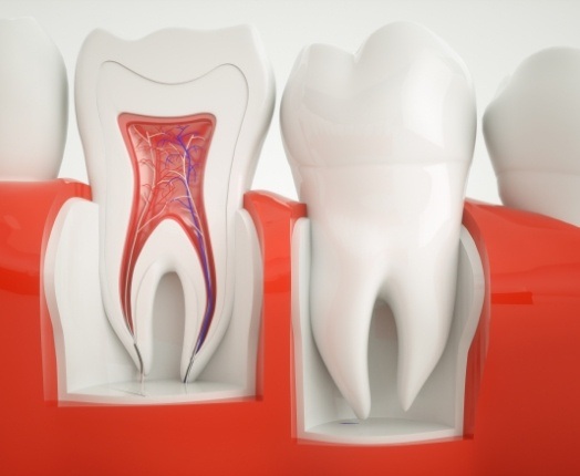 Animated inside of a tooth used to explain root canal therapy process