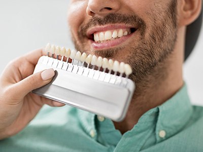 A smiling woman holding a take-home teeth whitening tray