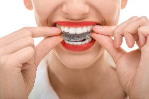 woman inserting aligners