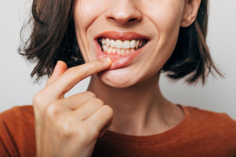 A close-up shot of a woman showing her gums