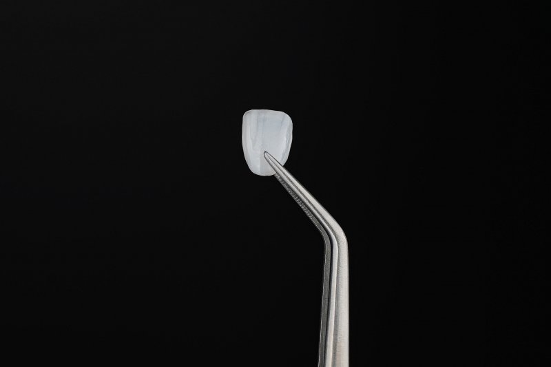 Dental veneer held with tweezers